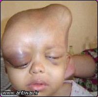 iraq2